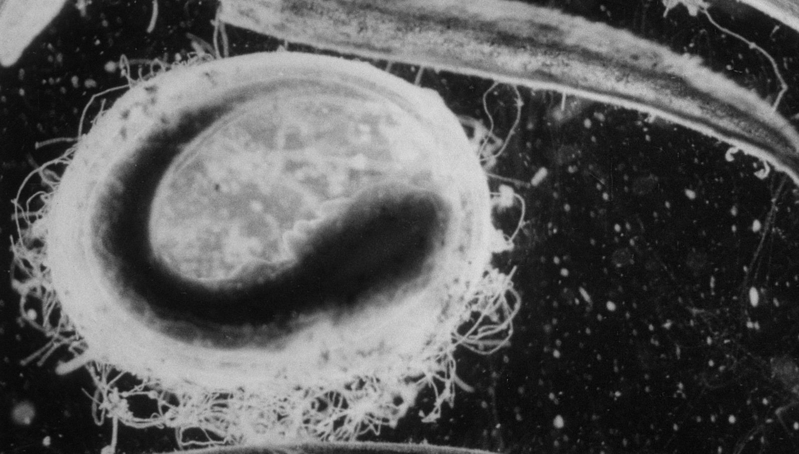 Close-up of a hairy underwater amoeba in black and white